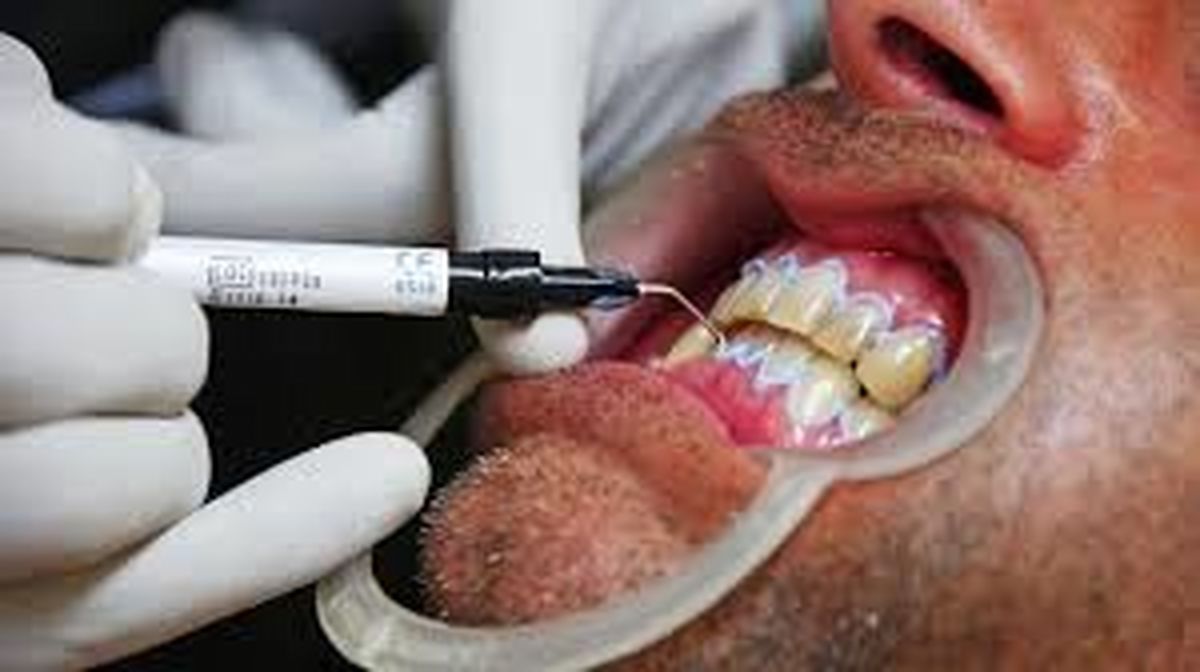 بیش از نیمی از مردم ایران از پس هزینه های دندانپزشکی بر نمی‌آیند